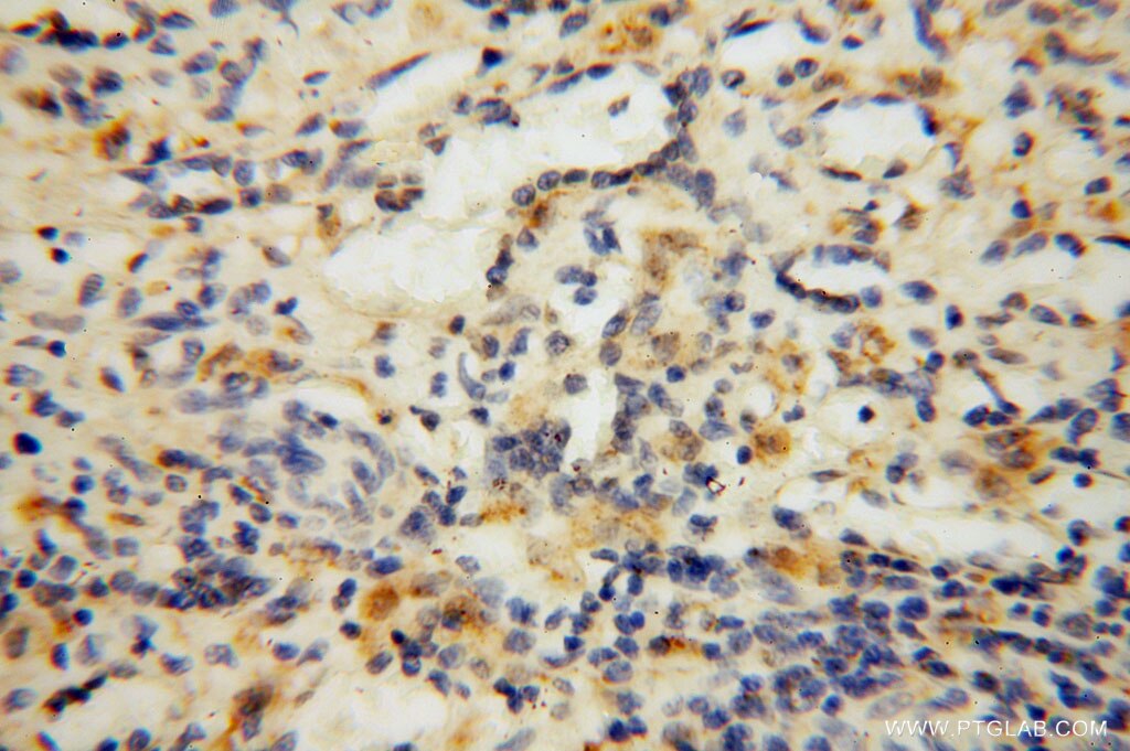 Immunohistochemistry (IHC) staining of human spleen tissue using Carboxypeptidase A1 Polyclonal antibody (15836-1-AP)