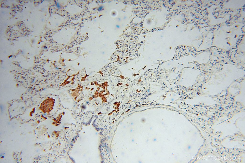 Immunohistochemistry (IHC) staining of human lung tissue using Carboxypeptidase A1 Polyclonal antibody (15836-1-AP)