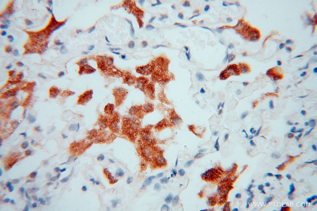 Immunohistochemistry (IHC) staining of human lung tissue using Carboxypeptidase A1 Polyclonal antibody (15836-1-AP)