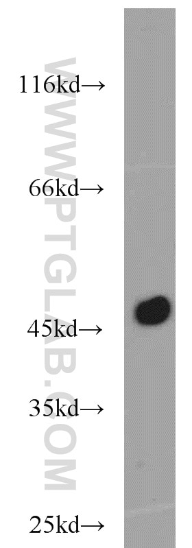 Western Blot (WB) analysis of mouse pancreas tissue using Carboxypeptidase A1 Polyclonal antibody (15836-1-AP)