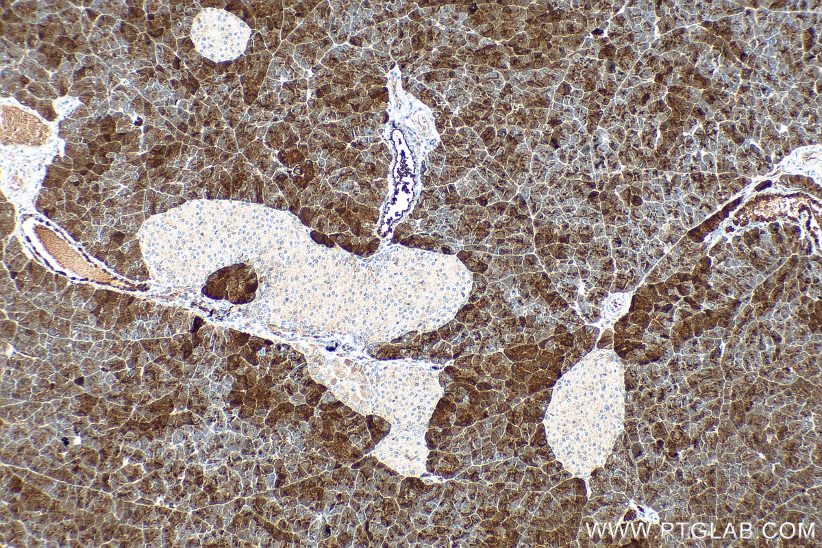 Immunohistochemistry (IHC) staining of mouse pancreas tissue using CPA1 Monoclonal antibody (68826-1-Ig)