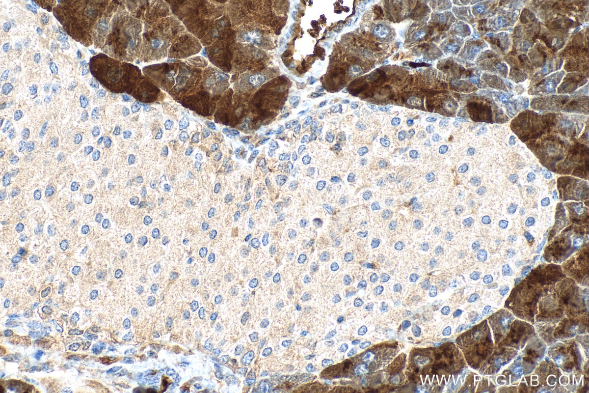 Immunohistochemistry (IHC) staining of mouse pancreas tissue using CPA1 Monoclonal antibody (68826-1-Ig)
