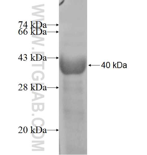 CPA1 fusion protein Ag8579 SDS-PAGE