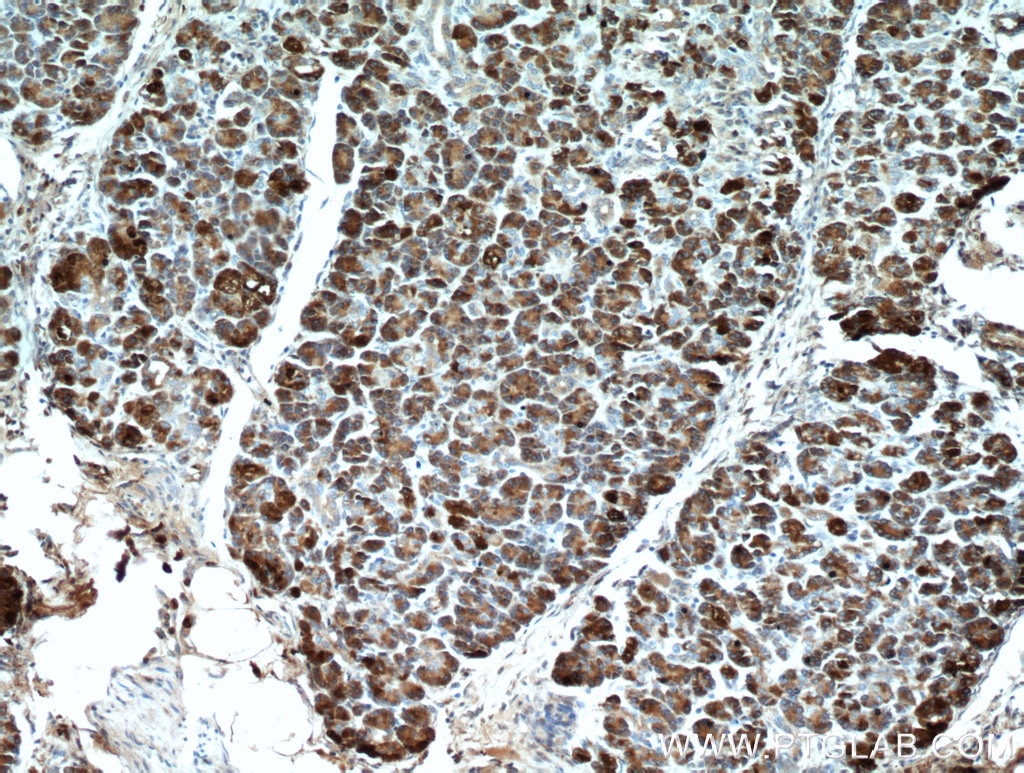 Immunohistochemistry (IHC) staining of human pancreas tissue using Carboxypeptidase A2 Polyclonal antibody (15626-1-AP)