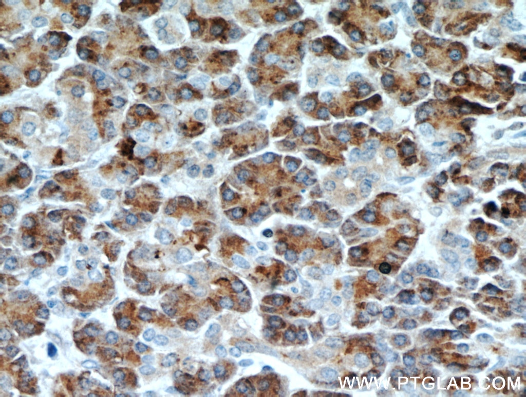 Immunohistochemistry (IHC) staining of human pancreas tissue using Carboxypeptidase A2 Polyclonal antibody (15626-1-AP)