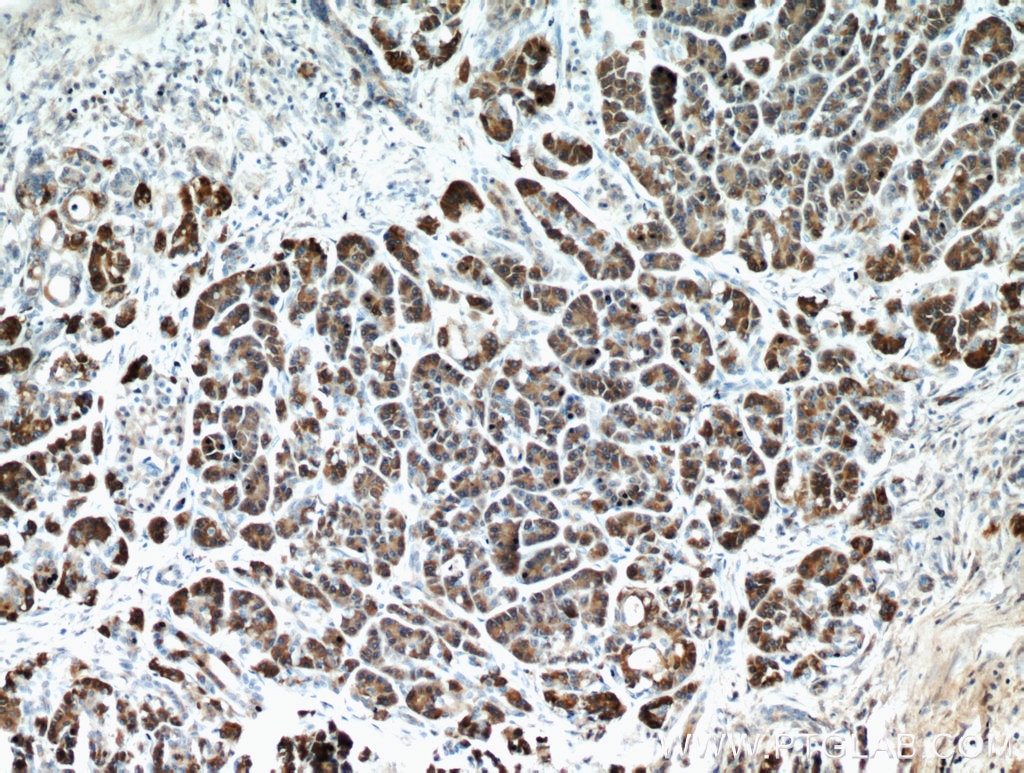 IHC staining of human pancreas using 15626-1-AP