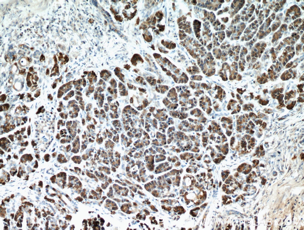 Immunohistochemistry (IHC) staining of human pancreas tissue using Carboxypeptidase A2 Polyclonal antibody (15626-1-AP)