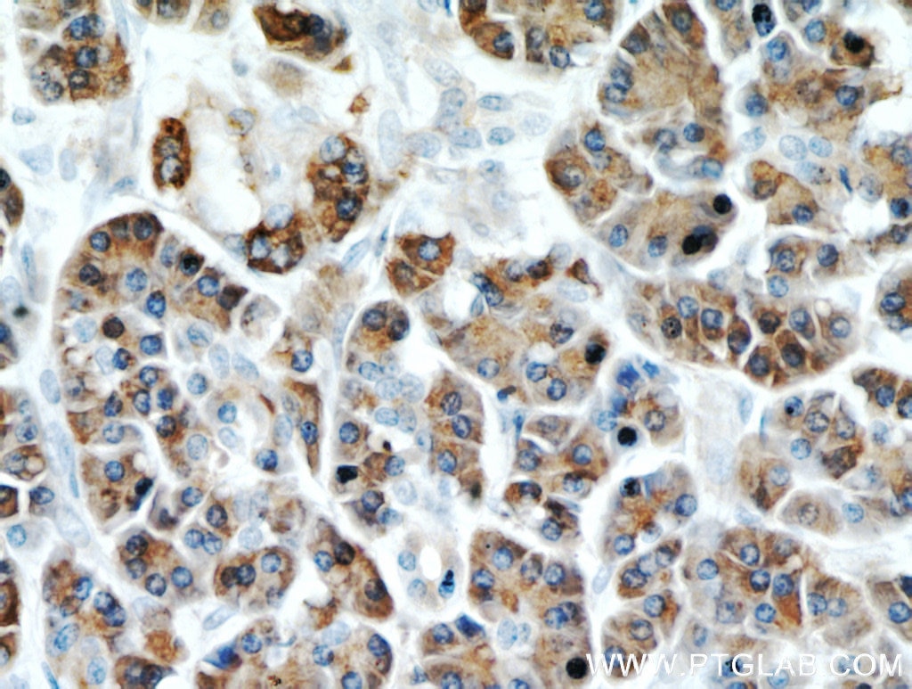 Immunohistochemistry (IHC) staining of human pancreas tissue using Carboxypeptidase A2 Polyclonal antibody (15626-1-AP)