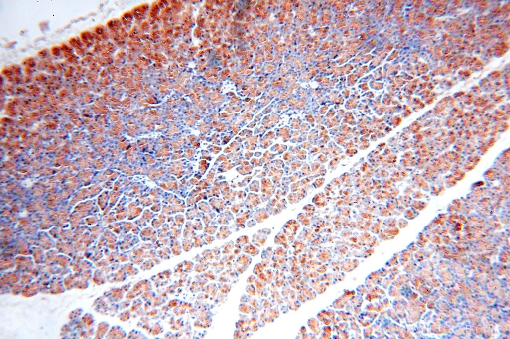 Immunohistochemistry (IHC) staining of human pancreas tissue using Carboxypeptidase A2 Polyclonal antibody (15626-1-AP)