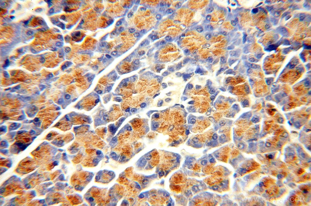 Immunohistochemistry (IHC) staining of human pancreas tissue using Carboxypeptidase A2 Polyclonal antibody (15626-1-AP)