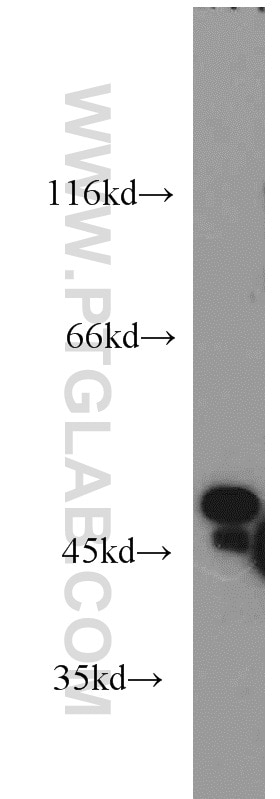 Western Blot (WB) analysis of mouse pancreas tissue using Carboxypeptidase A2 Polyclonal antibody (15626-1-AP)