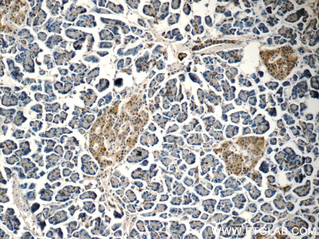 Immunohistochemistry (IHC) staining of human pancreas tissue using Carboxypeptidase A3 Polyclonal antibody (16236-1-AP)