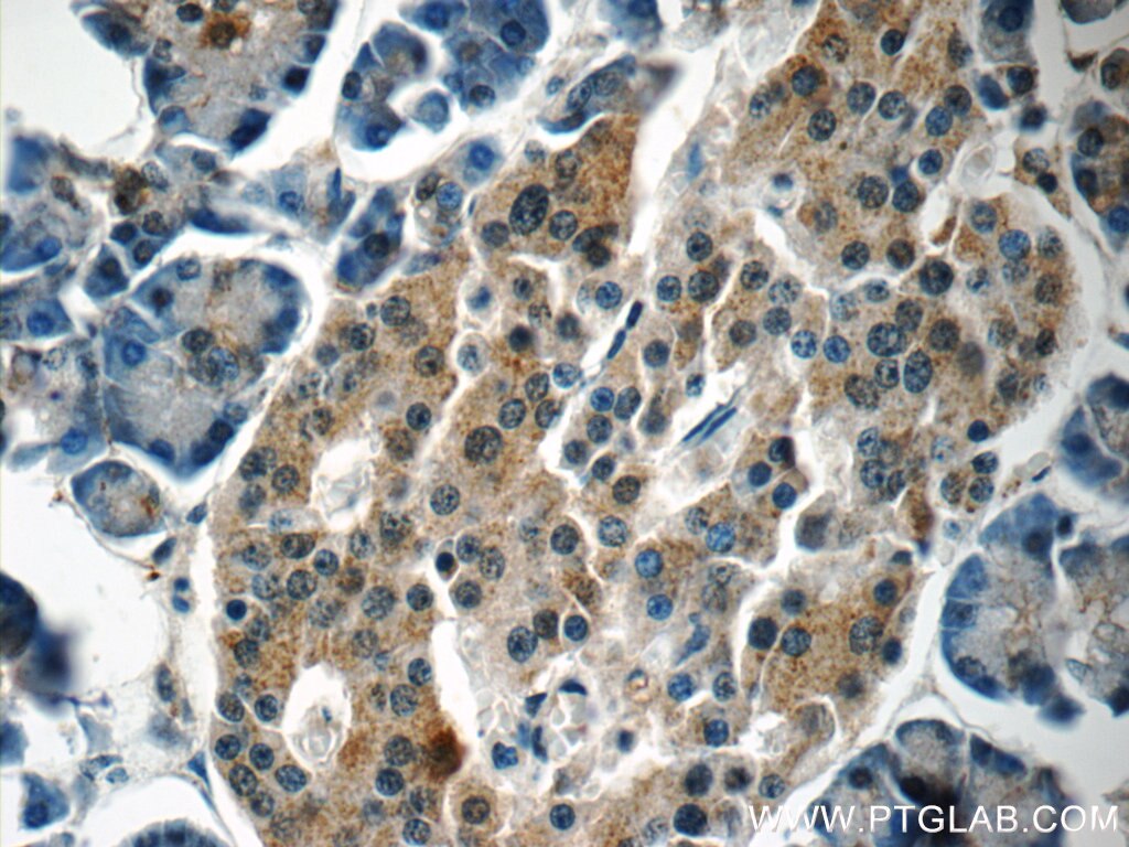 Immunohistochemistry (IHC) staining of human pancreas tissue using Carboxypeptidase A3 Polyclonal antibody (16236-1-AP)