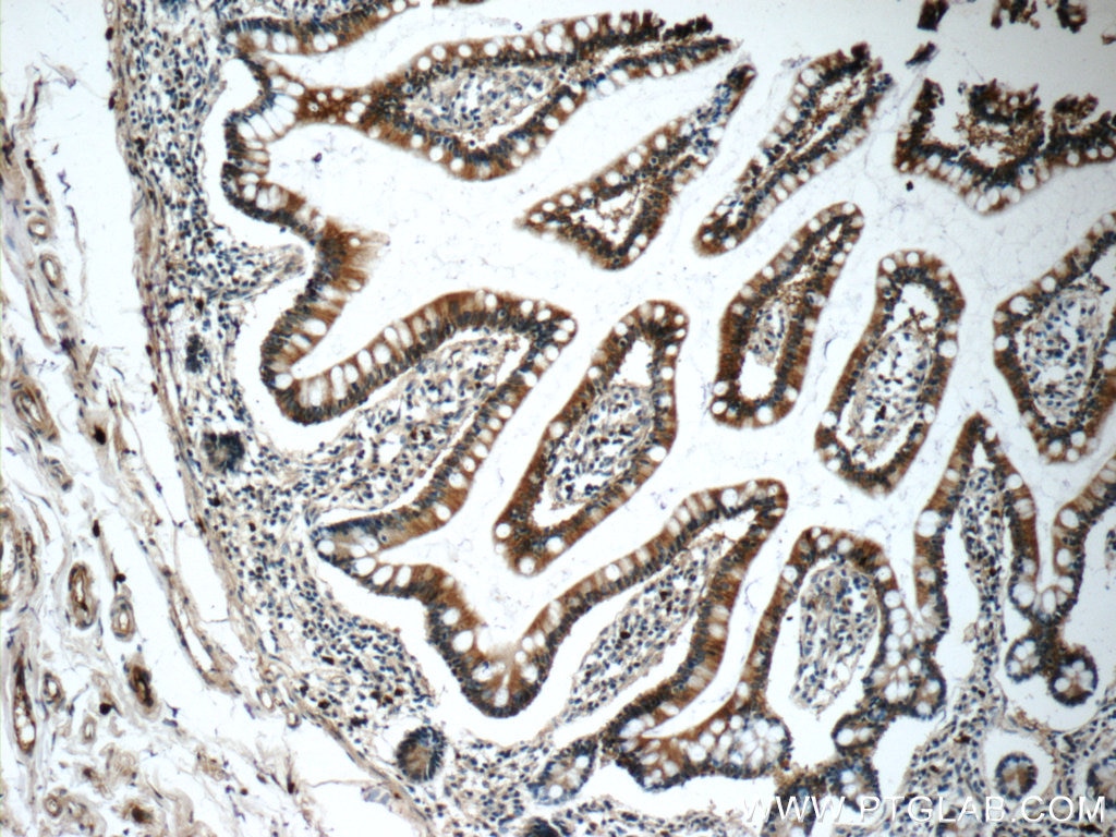 IHC staining of human small intestine using 16236-1-AP