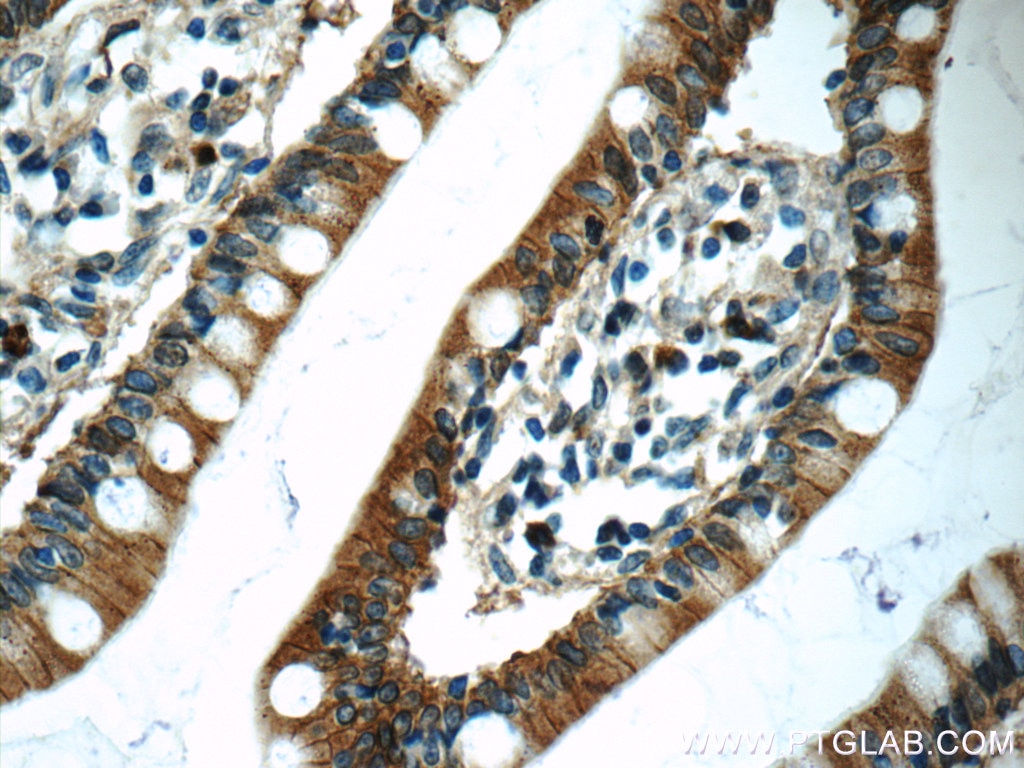 Immunohistochemistry (IHC) staining of human small intestine tissue using Carboxypeptidase A3 Polyclonal antibody (16236-1-AP)