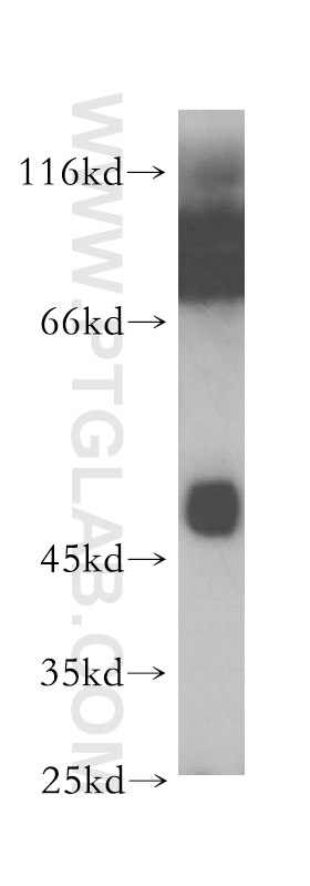 Western Blot (WB) analysis of mouse pancreas tissue using Carboxypeptidase A3 Polyclonal antibody (16236-1-AP)