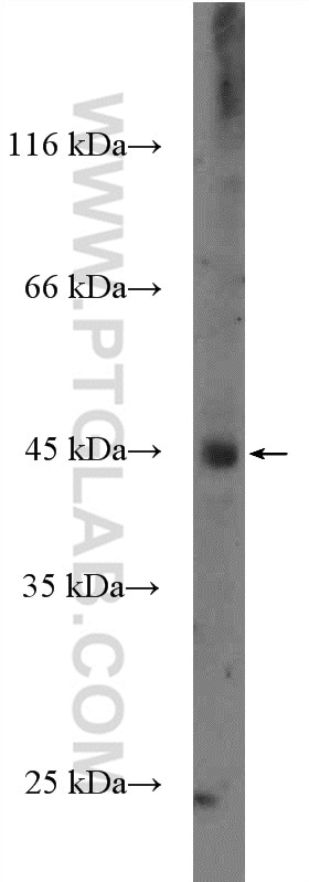 Western Blot (WB) analysis of mouse heart tissue using CPA4 Polyclonal antibody (26824-1-AP)