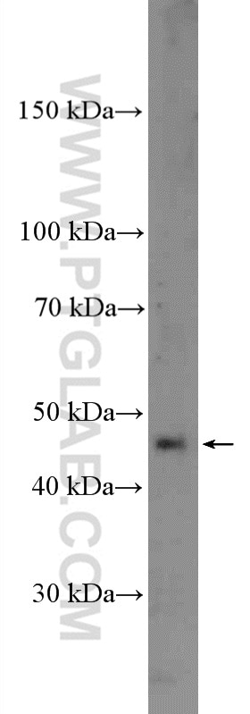 Western Blot (WB) analysis of mouse kidney tissue using CPA4 Polyclonal antibody (26824-1-AP)