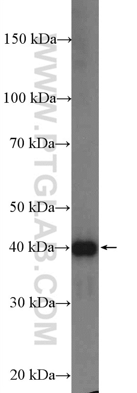 Western Blot (WB) analysis of A549 cells using CPA4 Polyclonal antibody (26824-1-AP)