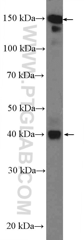 Western Blot (WB) analysis of SMMC-7721 cells using CPA4 Polyclonal antibody (26824-1-AP)