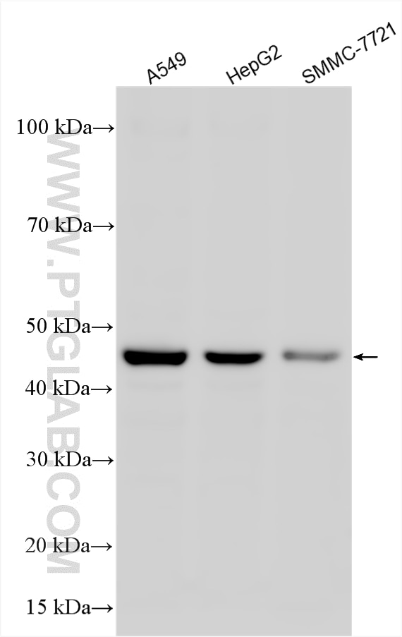 WB analysis using 26824-1-AP Western Blot (WB) analysis of various lysates using CPA4 Polyclonal antibody (26824-1-AP)