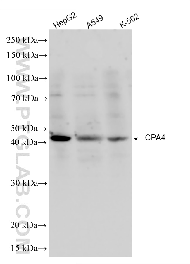 Western Blot (WB) analysis of various lysates using CPA4 Recombinant monoclonal antibody (87695-1-RR)