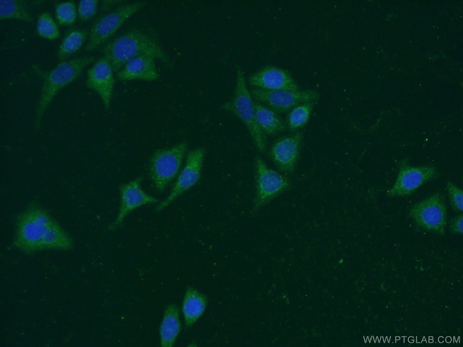 Immunofluorescence (IF) / fluorescent staining of PC-3 cells using Carboxypeptidase A5 Polyclonal antibody (13731-1-AP)