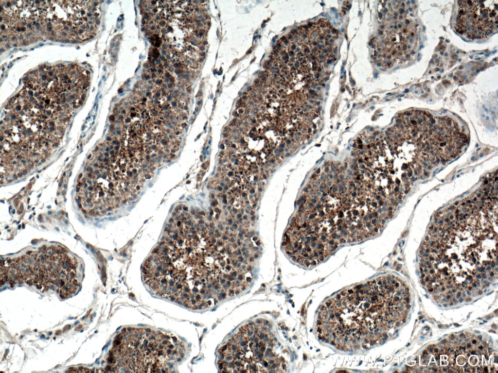 Immunohistochemistry (IHC) staining of human testis tissue using Carboxypeptidase A5 Polyclonal antibody (13731-1-AP)