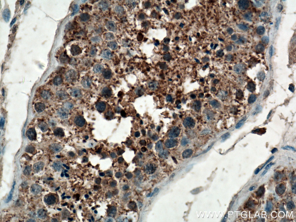 Immunohistochemistry (IHC) staining of human testis tissue using Carboxypeptidase A5 Polyclonal antibody (13731-1-AP)