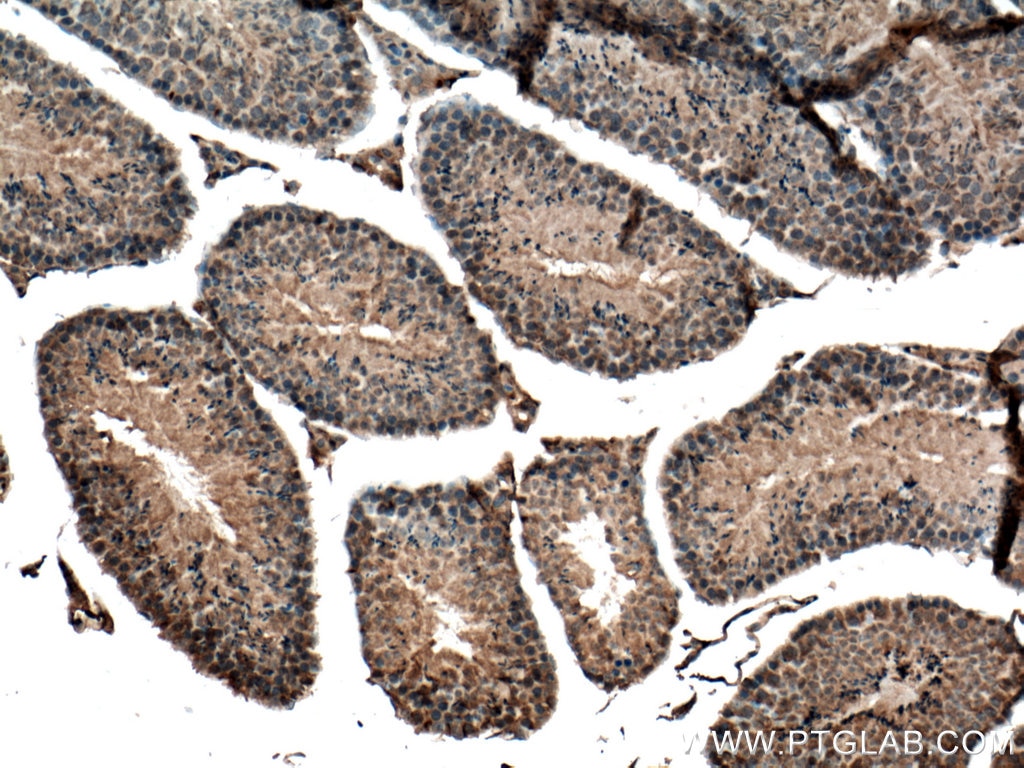 Immunohistochemistry (IHC) staining of mouse testis tissue using Carboxypeptidase A5 Polyclonal antibody (13731-1-AP)