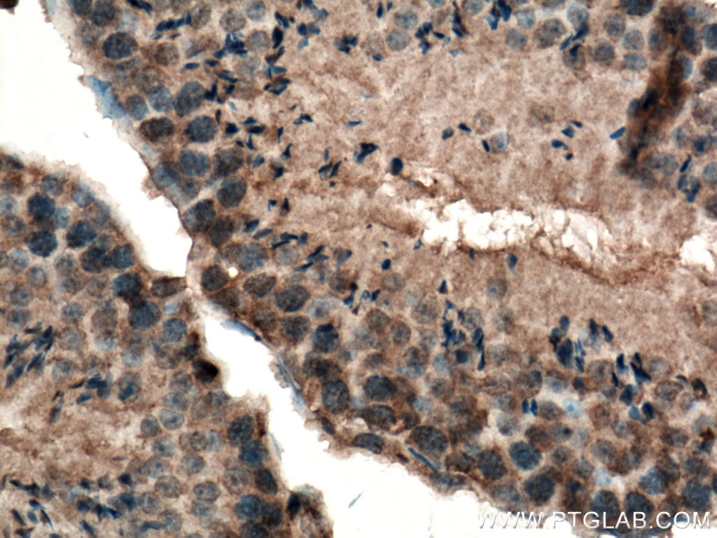 Immunohistochemistry (IHC) staining of mouse testis tissue using Carboxypeptidase A5 Polyclonal antibody (13731-1-AP)