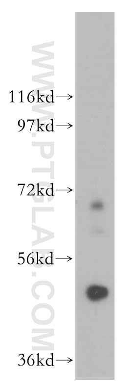 Western Blot (WB) analysis of PC-3 cells using Carboxypeptidase A5 Polyclonal antibody (13731-1-AP)