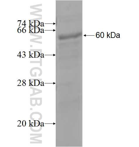 CPA5 fusion protein Ag4755 SDS-PAGE