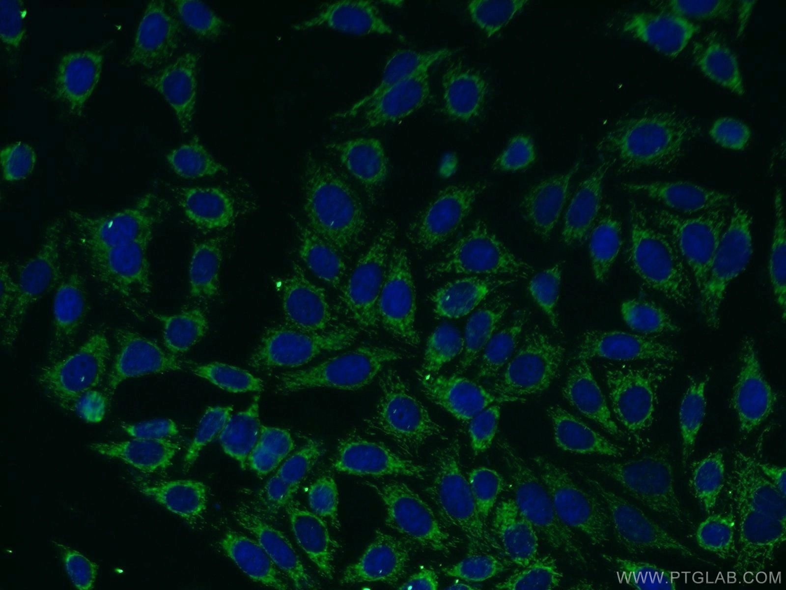 Immunofluorescence (IF) / fluorescent staining of HepG2 cells using Carboxypeptidase A6 Polyclonal antibody (13604-1-AP)