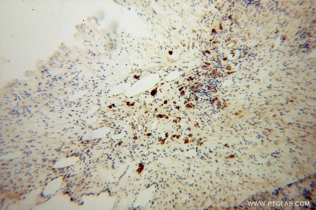 Carboxypeptidase A6