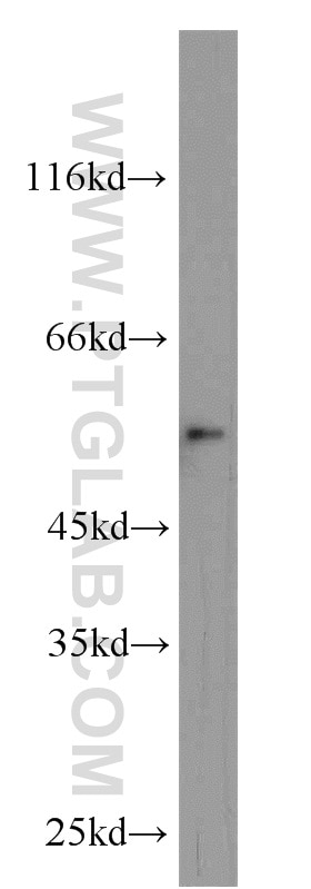 Western Blot (WB) analysis of mouse brain tissue using Carboxypeptidase A6 Polyclonal antibody (13604-1-AP)