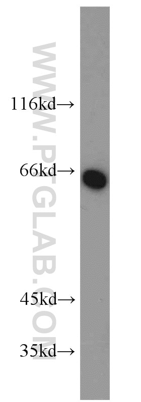 Western Blot (WB) analysis of HepG2 cells using Carboxypeptidase A6 Polyclonal antibody (13604-1-AP)