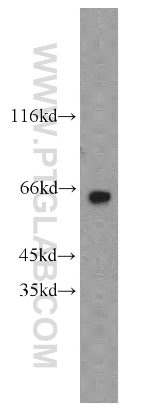 Western Blot (WB) analysis of HepG2 cells using Carboxypeptidase A6 Polyclonal antibody (13604-1-AP)