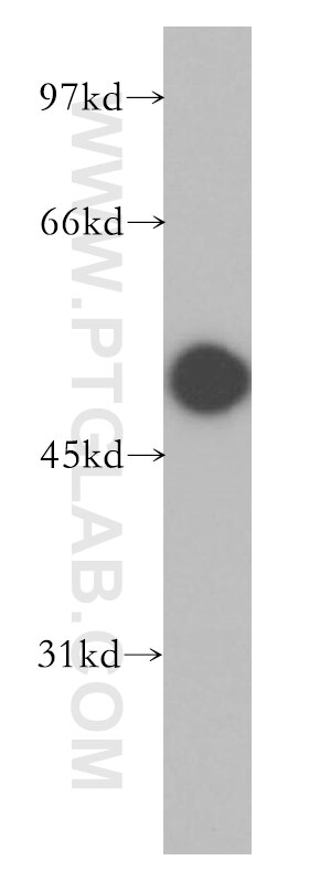 Western Blot (WB) analysis of mouse brain tissue using Carboxypeptidase A6 Polyclonal antibody (13604-1-AP)