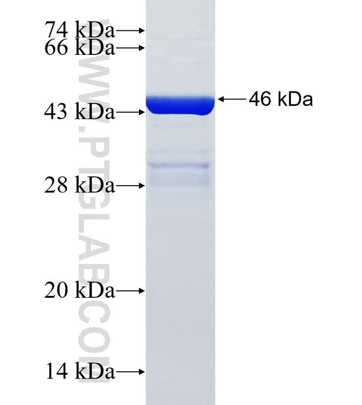 CPAMD8 fusion protein Ag35431 SDS-PAGE