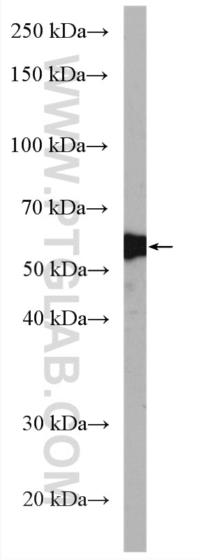 Western Blot (WB) analysis of mouse liver tissue using Carboxypeptidase B2 Polyclonal antibody (10672-1-AP)