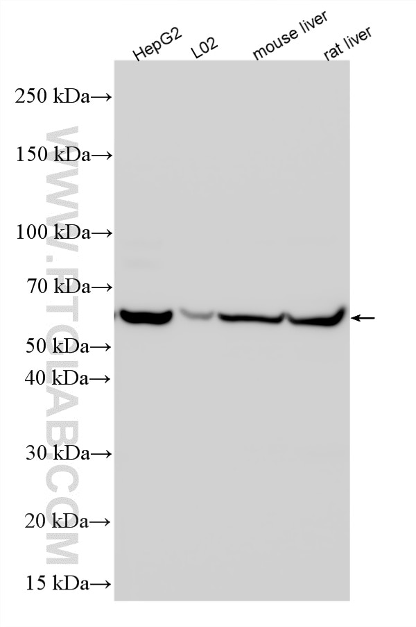WB analysis using 10672-1-AP Western Blot (WB) analysis of various lysates using Carboxypeptidase B2 Polyclonal antibody (10672-1-AP)