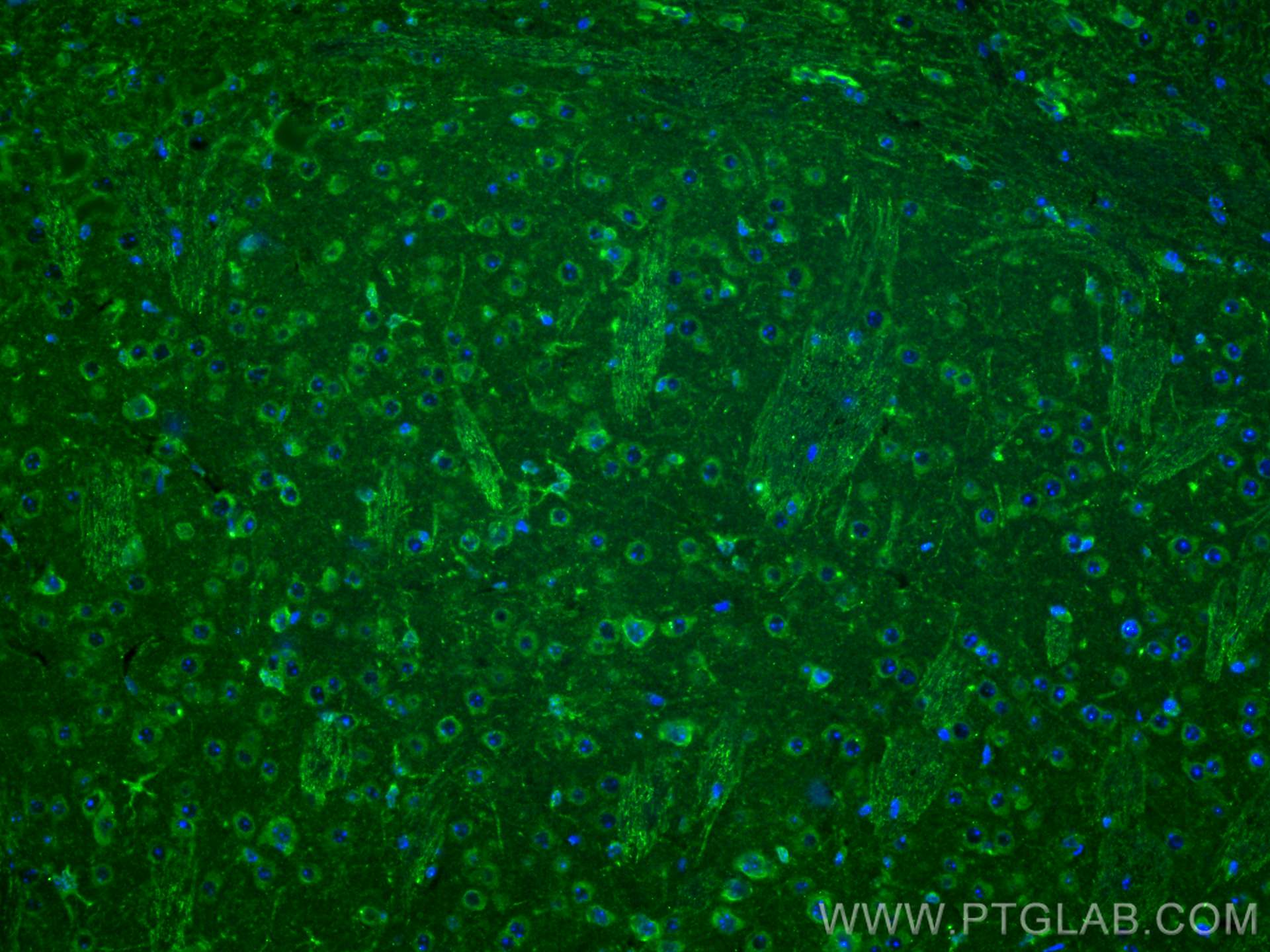 Immunofluorescence (IF) / fluorescent staining of mouse brain tissue using Carboxypeptidase E Polyclonal antibody (13710-1-AP)