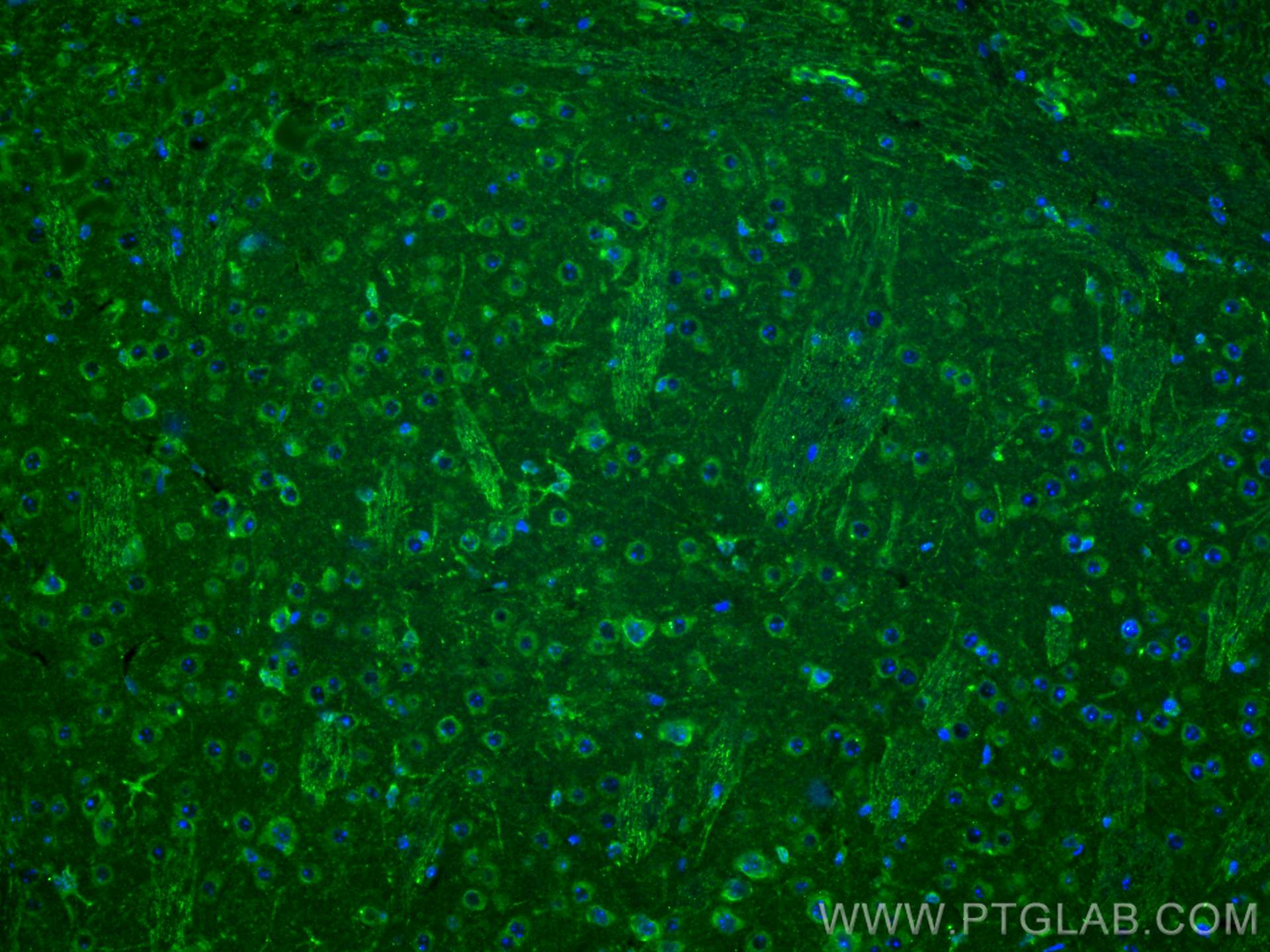 IF Staining of mouse brain using 13710-1-AP