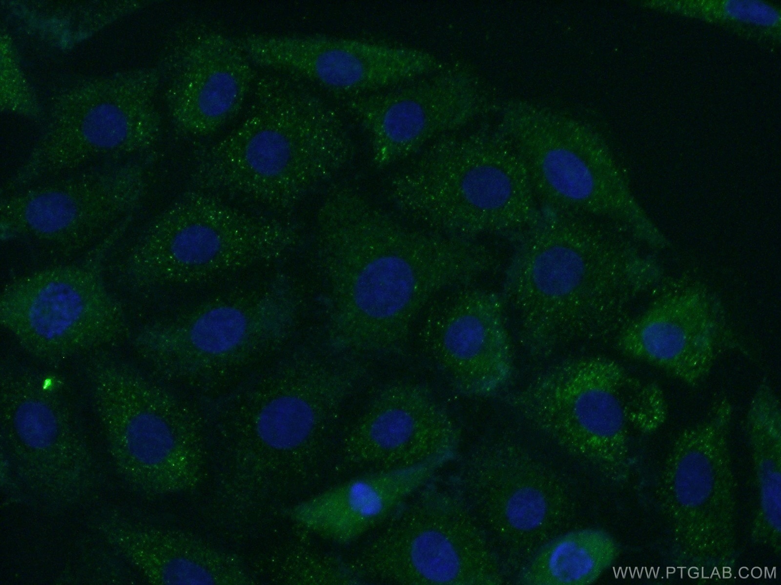 IF Staining of SH-SY5Y using 13710-1-AP