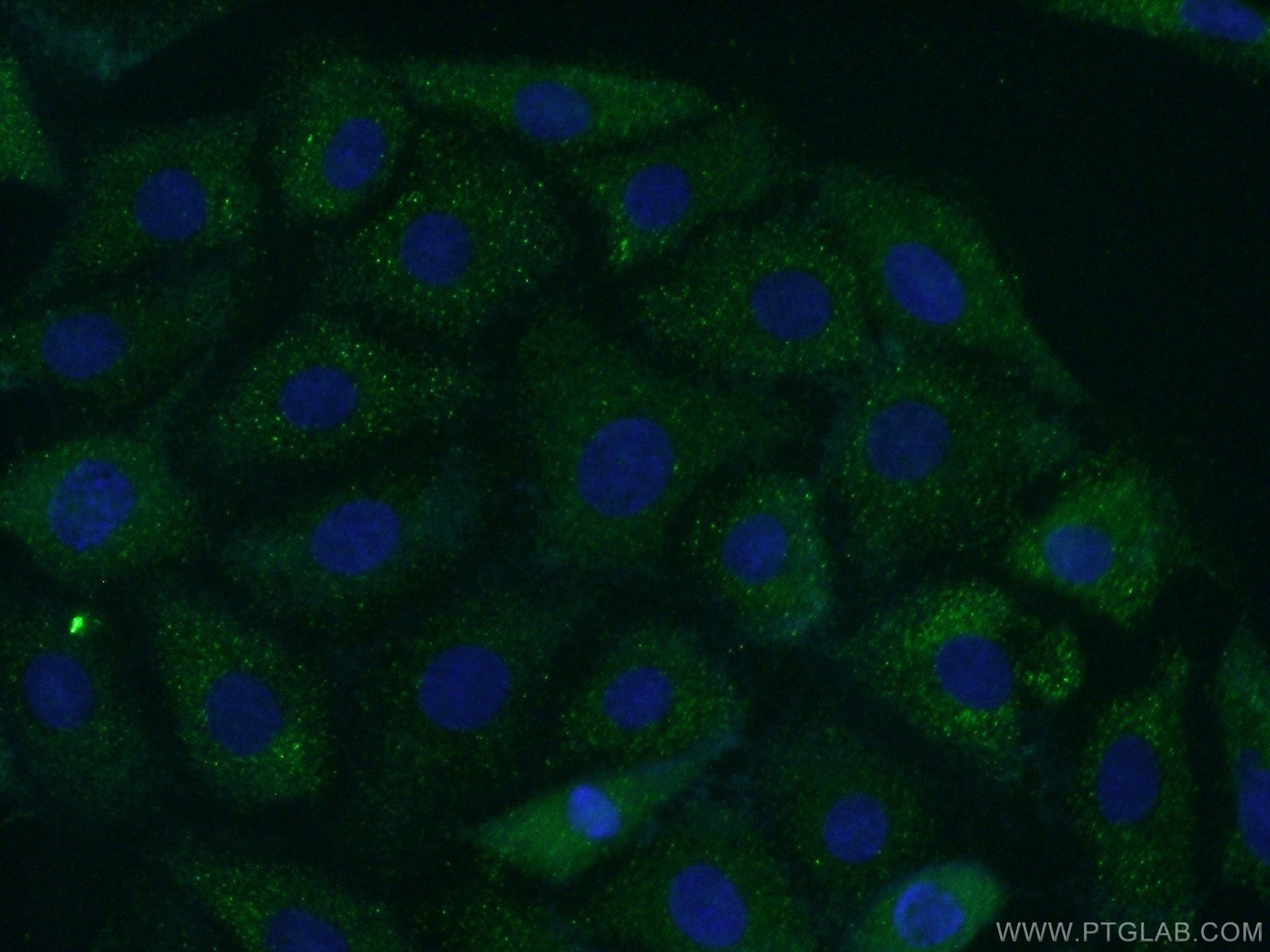 Carboxypeptidase E