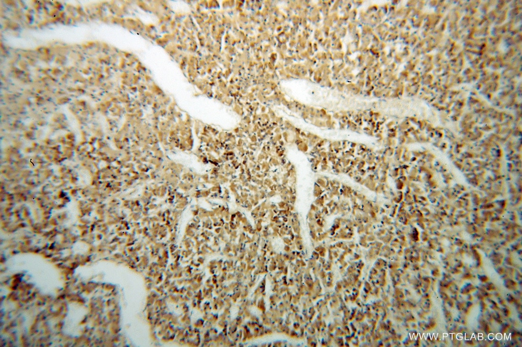 Immunohistochemistry (IHC) staining of human pituitary tissue using Carboxypeptidase E Polyclonal antibody (13710-1-AP)