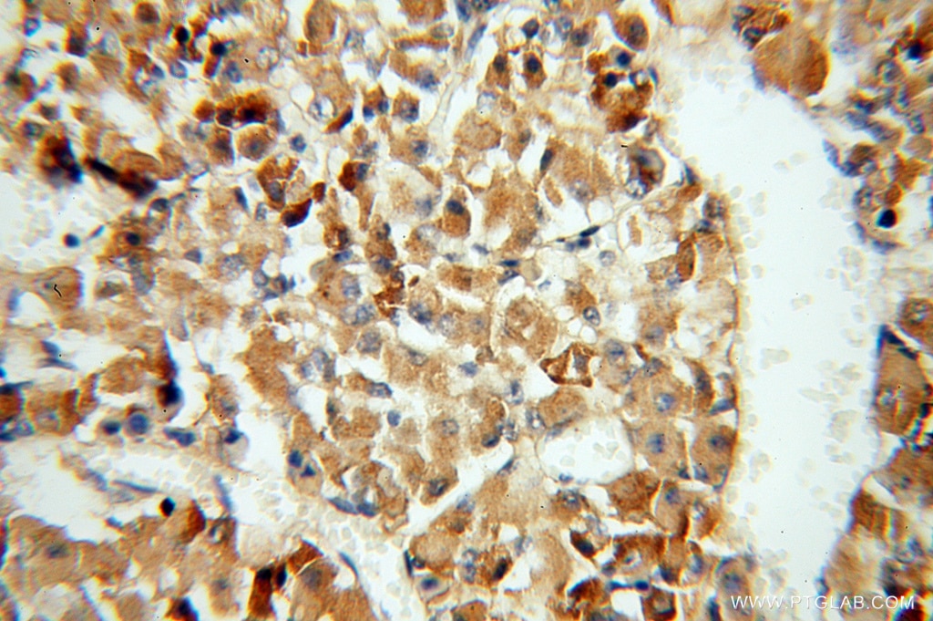 Immunohistochemistry (IHC) staining of human pituitary tissue using Carboxypeptidase E Polyclonal antibody (13710-1-AP)