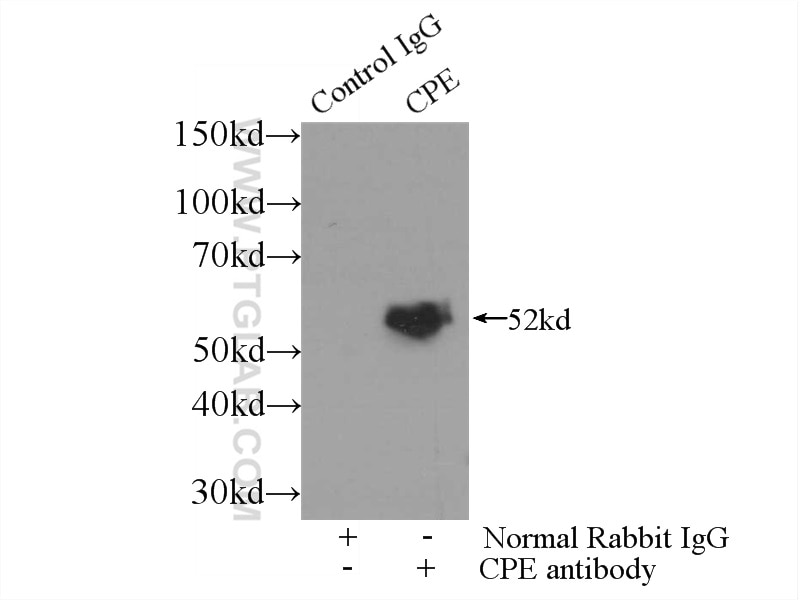 Immunoprecipitation (IP) experiment of mouse brain tissue using Carboxypeptidase E Polyclonal antibody (13710-1-AP)