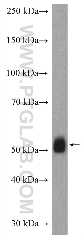 Western Blot (WB) analysis of mouse brain tissue using Carboxypeptidase E Polyclonal antibody (13710-1-AP)